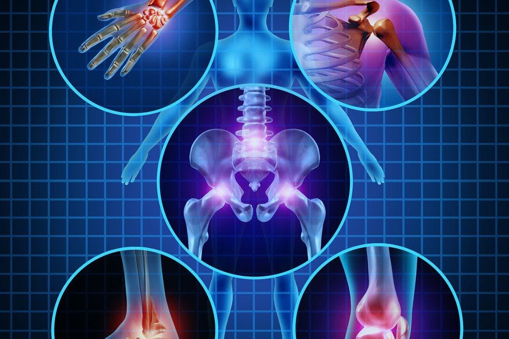 Helping You Manage Joint Pain with Physical Therapy